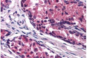 Human Prostate (formalin-fixed, paraffin-embedded) stained with SNX26 antibody ABIN290201 at 1. (SNX26 anticorps  (AA 3-14))