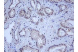 Image no. 9 for anti-DEAD (Asp-Glu-Ala-Asp) Box Polypeptide 59 (DDX59) (AA 1-303) antibody (ABIN1490728) (DDX59 anticorps  (AA 1-303))