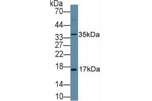 Rabbit Detection antibody from the kit in WB with Positive Control: Human placenta tissue. (Ki-67 Kit ELISA)