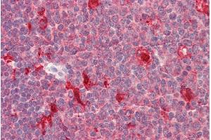 ABIN768629 (5µg/ml) staining of paraffin embedded Human Tonsil.