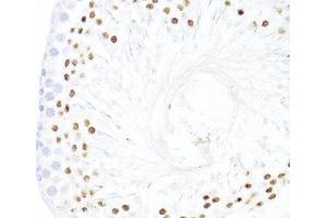 Immunohistochemistry of paraffin-embedded Rat testis using DDX59 Polyclonal Antibody at dilution of 1:100 (40x lens). (DDX59 anticorps)