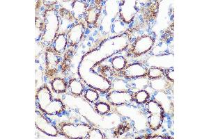 Immunohistochemistry of paraffin-embedded Mouse kidney using FGF2 Rabbit pAb (ABIN3020744, ABIN3020745, ABIN3020746 and ABIN6213702) at dilution of 1:100 (40x lens). (FGF2 anticorps  (AA 143-288))