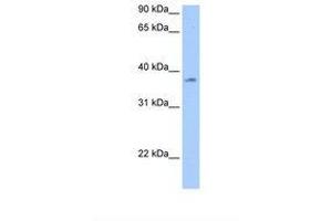 Image no. 1 for anti-RNA Binding Motif Protein, Y-Linked Family 1 Member A1 (RBMY1A1) (AA 141-190) antibody (ABIN6737904)