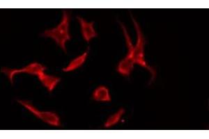 ABIN6275575 staining NIH-3T3 by IF/ICC. (SLC4A11 anticorps  (Internal Region))