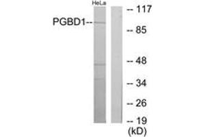 Western Blotting (WB) image for anti-PiggyBac Transposable Element Derived 1 (PGBD1) (AA 241-290) antibody (ABIN2889725) (PGBD1 anticorps  (AA 241-290))