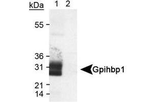Western blot analysis of Gpihbp1 in transfected lysate (Lane 1) using Gpihbp1 polyclonal antibody . (GPIHBP1 anticorps  (AA 170-250))