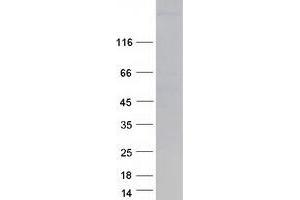 Validation with Western Blot