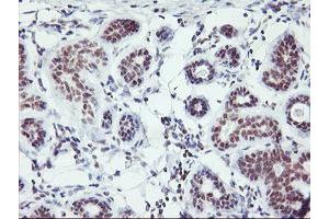 Immunohistochemical staining of paraffin-embedded Human breast tissue using anti-RNF113B mouse monoclonal antibody. (RNF113B anticorps)