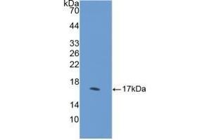 Detection of Recombinant DHH, Human using Polyclonal Antibody to Hedgehog Homolog, Desert (DHH)