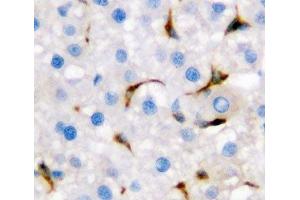 IHC-P: CD68 antibody testing of rat liver tissue (CD68 anticorps  (AA 312-326))