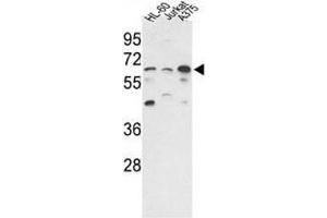Western blot analysis of PPP3CC antibody and HL-60, Jurkat, A375 lysate. (PPP3CC anticorps  (AA 18-47))