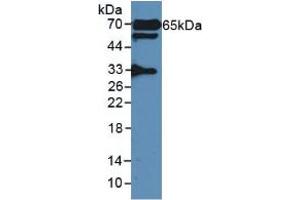 Figure. (GAD65 anticorps  (AA 188-374))