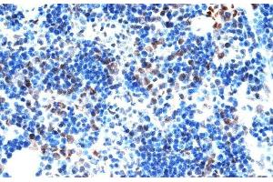 Immunohistochemistry of paraffin-embedded Rat spleen using AQR Polyclonal Antibody at dilution of 1:100 (40x lens). (AQR anticorps)