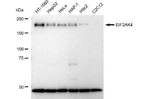Western blotting analysis using EIF2AK4 antibody (ABIN7798505).