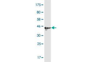 Western Blot detection against Immunogen (40. (CCDC115 anticorps  (AA 1-132))