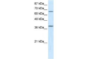 ACADM antibody used at 5 ug/ml to detect target protein. (Medium-Chain Specific Acyl-CoA Dehydrogenase, Mitochondrial (N-Term) anticorps)