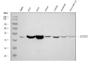 Western blot analysis of Epoxide hydrolase/EPHX1 using anti-Epoxide hydrolase/EPHX1 antibody (ABIN7601696).