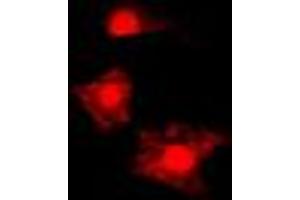 Immunofluorescent analysis of FAST Kinase staining in HL60 cells. (FASTK anticorps  (Center))