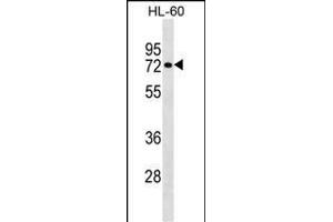 RHOT2 Antibody (Center) (ABIN1538254 and ABIN2848958) western blot analysis in HL-60 cell line lysates (35 μg/lane). (RHOT2 anticorps  (AA 291-320))