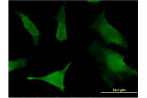 Immunofluorescence of monoclonal antibody to SLC6A16 on HeLa cell.