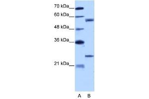 Copine I antibody used at 5 ug/ml to detect target protein. (CPNE1 anticorps  (N-Term))