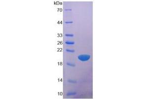 SDS-PAGE analysis of Human Glypican 1 Protein. (GPC1 Protéine)