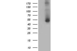 Western Blotting (WB) image for anti-Golgi Membrane Protein 1 (GOLM1) antibody (ABIN1498498) (GOLM1 anticorps)