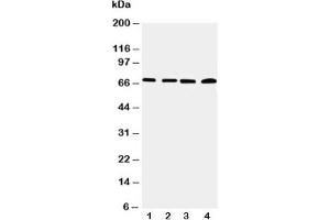 Western blot testing of IRAK2 antibody and Lane 1:  22RV;  2: A549;  3: PANC;  4: SMMC-7721 cell lysate (IRAK2 anticorps  (C-Term))