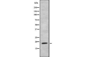 Western blot analysis of HEN1/2 using Jurkat whole cell lysates (HEN1/2 anticorps)
