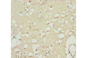 Immunohistochemistry of paraffin-embedded human brain tissue using ABIN7175594 at dilution of 1:100 (CACNB1 anticorps  (AA 429-598))