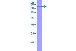 Image no. 1 for Proprotein Convertase Subtilisin/kexin Type 9 (PCSK9) (AA 1-678) protein (GST tag) (ABIN3013383)