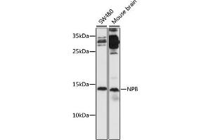Western blot analysis of extracts of various cell lines, using NPB antibody (ABIN7268885) at 1:1000 dilution. (Neuropeptide B anticorps  (AA 1-125))