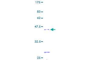 Image no. 1 for Succinate Dehydrogenase Complex, Subunit C, Integral Membrane Protein, 15kDa (SDHC) (AA 1-169) protein (GST tag) (ABIN1319367)