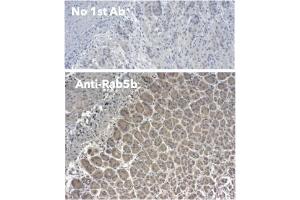 Immunohistochemistry (IHC) image for anti-RAB5B, Member RAS Oncogene Family (RAB5B) (C-Term) antibody (ABIN1439995)