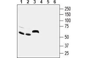 Western blot analysis of rat brain (lanes 1 and 4), mouse brain (lanes 2 and 5) and rat small intestine (lanes 3 and 6) lysates:1-3. (Amiloride-Sensitive Cation Channel 5, Intestinal (ACCN5) Peptide)