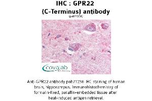 Image no. 1 for anti-G Protein-Coupled Receptor 22 (GPR22) (C-Term), (Cytoplasmic Domain) antibody (ABIN1735032) (GPR22 anticorps  (C-Term, Cytoplasmic Domain))