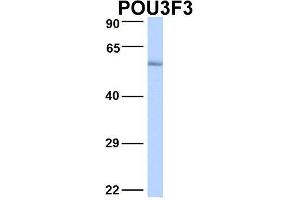 Host:  Rabbit  Target Name:  POU3F3  Sample Type:  Human Fetal Lung  Antibody Dilution:  1. (POU3F3 anticorps  (N-Term))