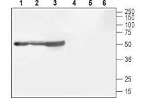 Western blot analysis of rat brain (lanes 1 and 4), mouse brain (lanes 2 and 5) and rat cortex (lane 3 and 6): - 1-3. (CACNB1 anticorps  (C-Term, Intracellular))