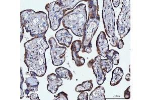 IHC analysis of VAPA using anti-VAPA antibody (ABIN7603249). (VAPA anticorps  (N-Term))