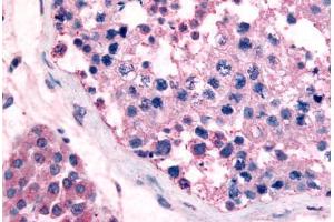 Human Testis (formalin-fixed, paraffin-embedded) stained with GPR18 antibody ABIN213453 at 5 ug/ml followed by biotinylated goat anti-rabbit IgG secondary antibody ABIN481713, alkaline phosphatase-streptavidin and chromogen.