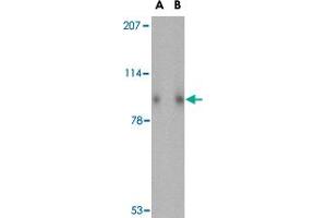 Western blot analysis of SLITRK1 in human brain tissue lysate with SLITRK1 polyclonal antibody  at (A) 1 and (B) 2 ug/mL . (SLITRK1 anticorps  (Internal Region))