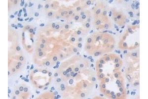 Detection of CECR1 in Human Kidney Tissue using Polyclonal Antibody to Cat Eye Syndrome Chromosome Region, Candidate 1 (CECR1) (CECR1 anticorps  (AA 30-511))