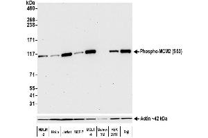 Western Blotting (WB) image for anti-Minichromosome Maintenance Complex Component 2 (MCM2) (pSer53) antibody (ABIN7449430) (Recombinant MCM2 anticorps  (pSer53))