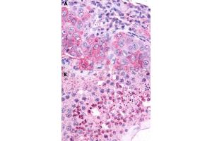 Immunohistochemical staining of formalin-fixed paraffin-embedded human lung (A) and human testis (B) with nMBR polyclonal antibody . (NMBR anticorps  (Cytoplasmic Domain))