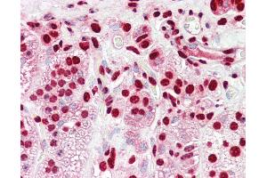 anti-Heterogeneous Nuclear Ribonucleoprotein K (HNRNPK) (AA 1-50) antibody