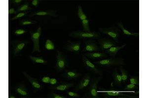 Immunofluorescence of purified MaxPab antibody to WDR79 on HeLa cell. (WRAP53 anticorps  (AA 1-548))
