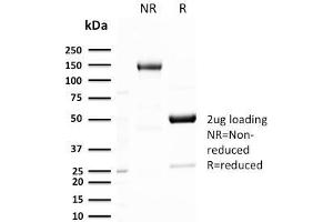 SDS-PAGE Analysis Purified GLUT-1 Recombinant Rabbit Monoclonal Antibody (GLUT1/3132R).