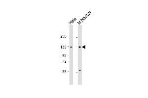 All lanes : Anti-Enpp1 Antibody (N-term) at 1:1000 dilution Lane 1: Hela whole cell lysate Lane 2: mouse bladder lysate Lysates/proteins at 20 μg per lane. (ENPP1 anticorps  (N-Term))