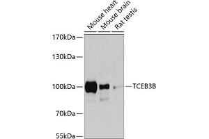 anti-Transcription Elongation Factor B Polypeptide 3B (Elongin A2) (TCEB3B) (AA 534-753) antibody