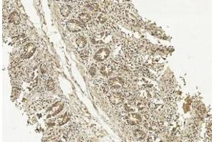 Immunohistochemical analysis of paraffin-embedded Human Small intestine section using Pink1 (ABIN1539798 and ABIN2843775). (METAP1 anticorps)